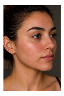 Before - Mascara Led